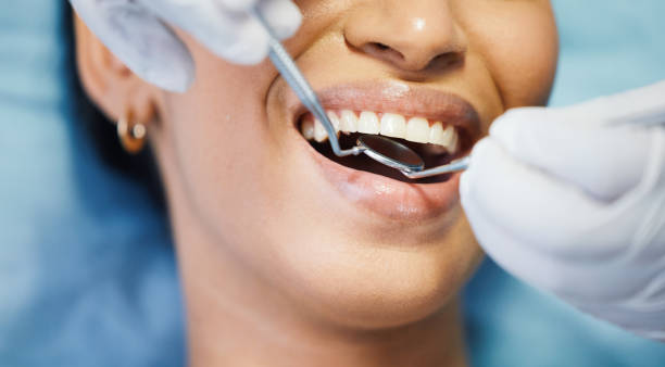 Best Emergency Treatment for Toothache in Haughton, LA